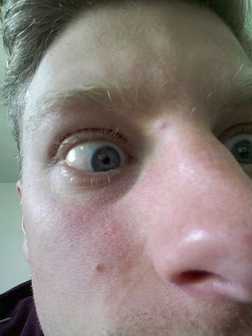 Felix Stare